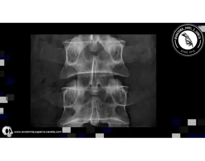 Coluna vertebral por RX - 1