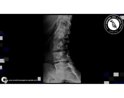 Coluna vertebral por RX - 3