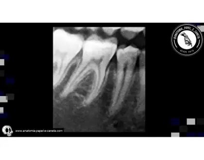 Dentes por RX - 1