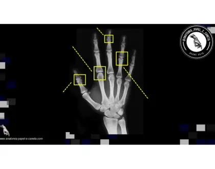 Ossos da mão por RX - 2