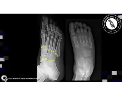 Ossos do tarso por rx - 2
